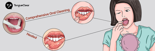 Why do oral ulcers occur and what should I do?