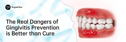 The Real Dangers of Gingivitis: Prevention is Better than Cure