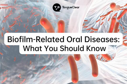 Biofilm-Related Oral Diseases: What You Should Know