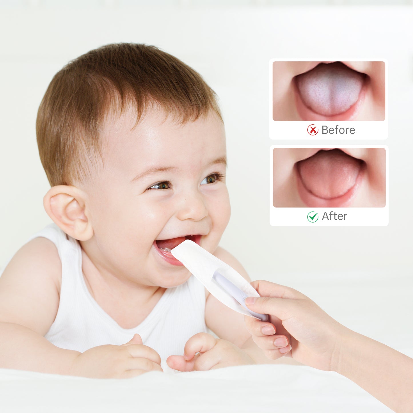 Tongueclear Baby Oral Cleaning Kit, Baby Airbag Oral Cleaner And Dry Oral Cleaning Finger Wipes，Essential For Teething